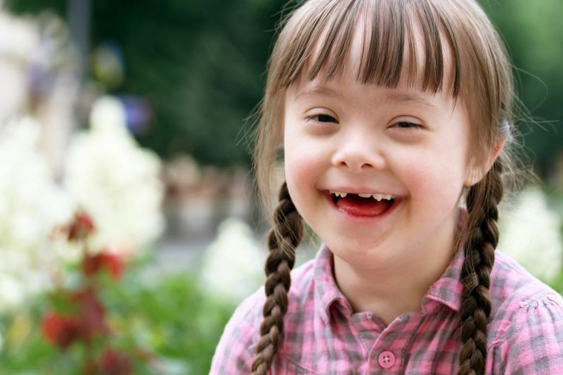 افزایش ریسک بروز سندروم داون با افزایش سن مادر