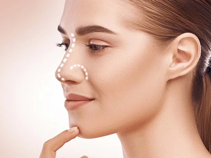 همه چیز درباره عمل بینی نچرال و طبیعی همه چیز درباره عمل بینی نچرال و طبیعی