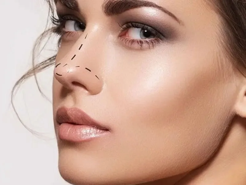همه چیز درباره عمل بینی نچرال و طبیعی همه چیز درباره عمل بینی نچرال و طبیعی