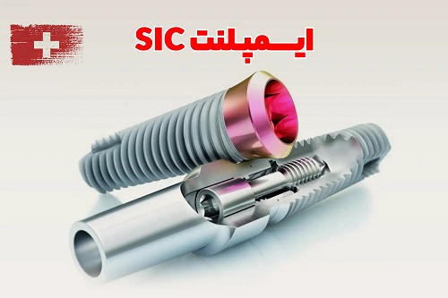 دلایلی که باعث شده ایمپلنت سوئیسی SIC در تهران محبوبتر از همیشه باشد دلایلی که باعث شده ایمپلنت سوئیسی SIC در تهران محبوبتر از همیشه باشد