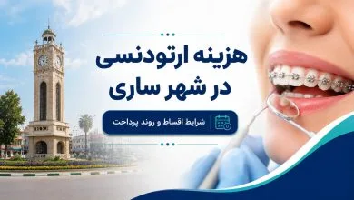 هزینه ارتودنسی در ساری چقدر است؟ شرایط اقساط و عوامل موثر بر قیمت